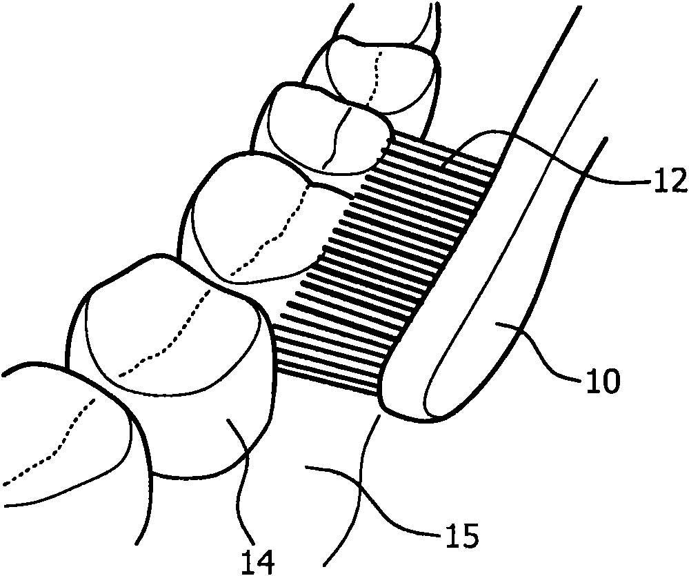 System for protection of soft tissues against a teeth whitening substance