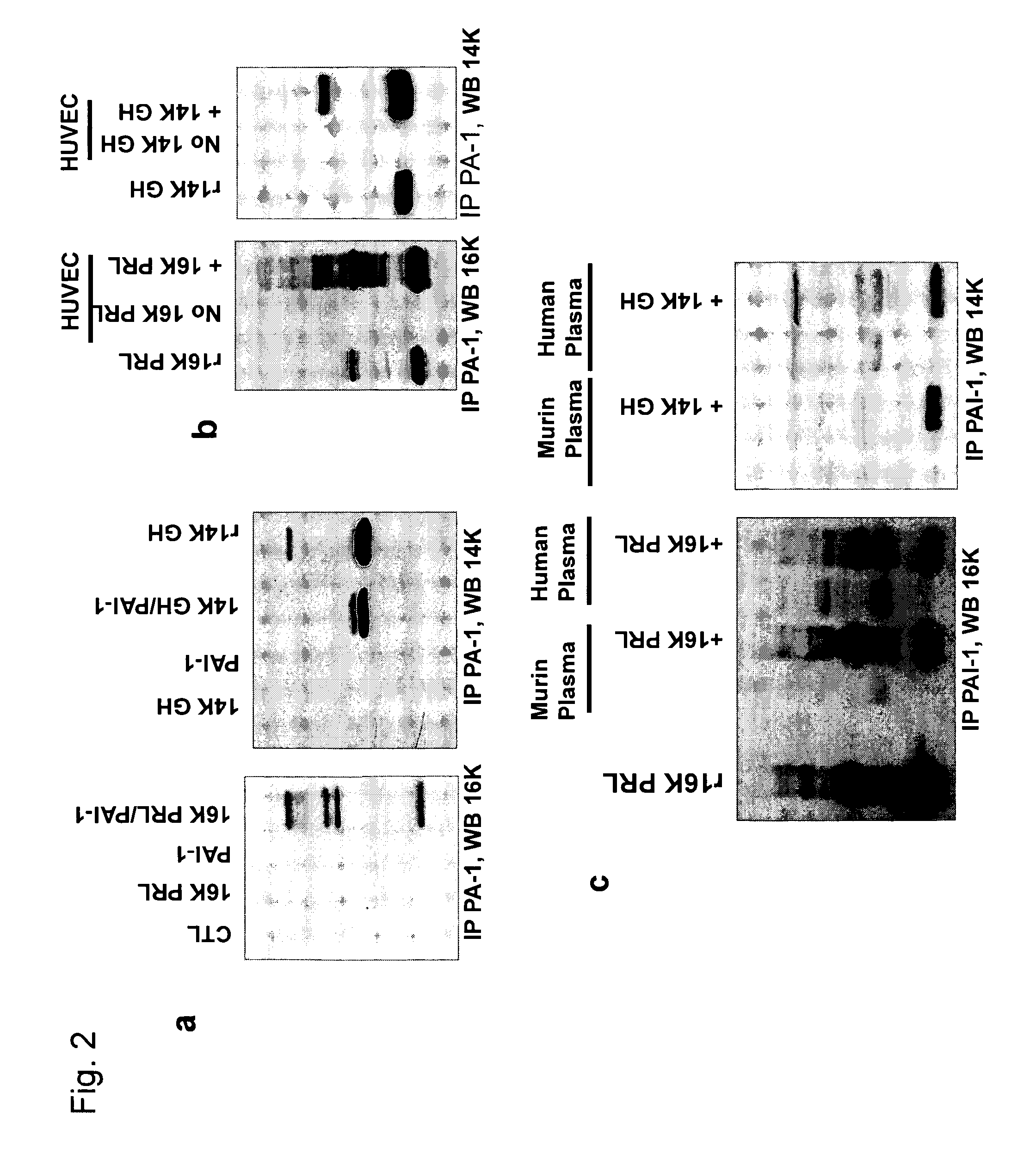 Pharmaceutical composition for treatment of thrombosis-related diseases comprising a fragment of prolactin (PRL)-growth hormone (GH)-placental lactogen (PL)-family protein