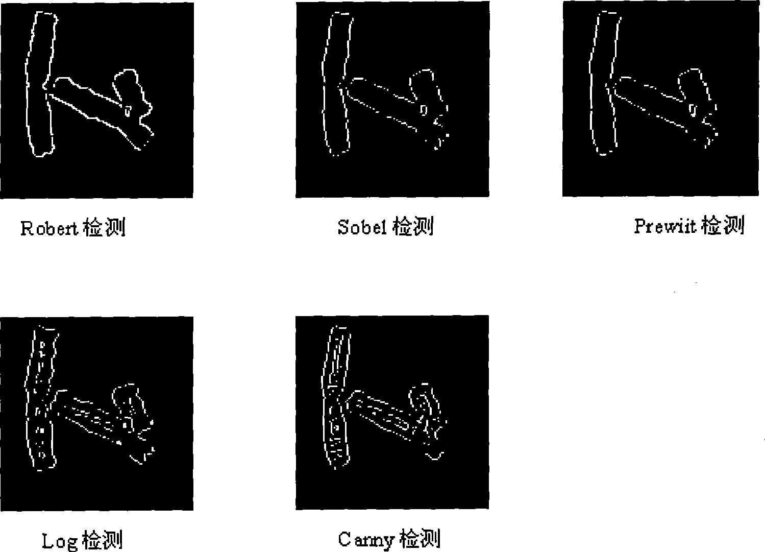 Method for detecting and extracting chromosome contour based on directional searching