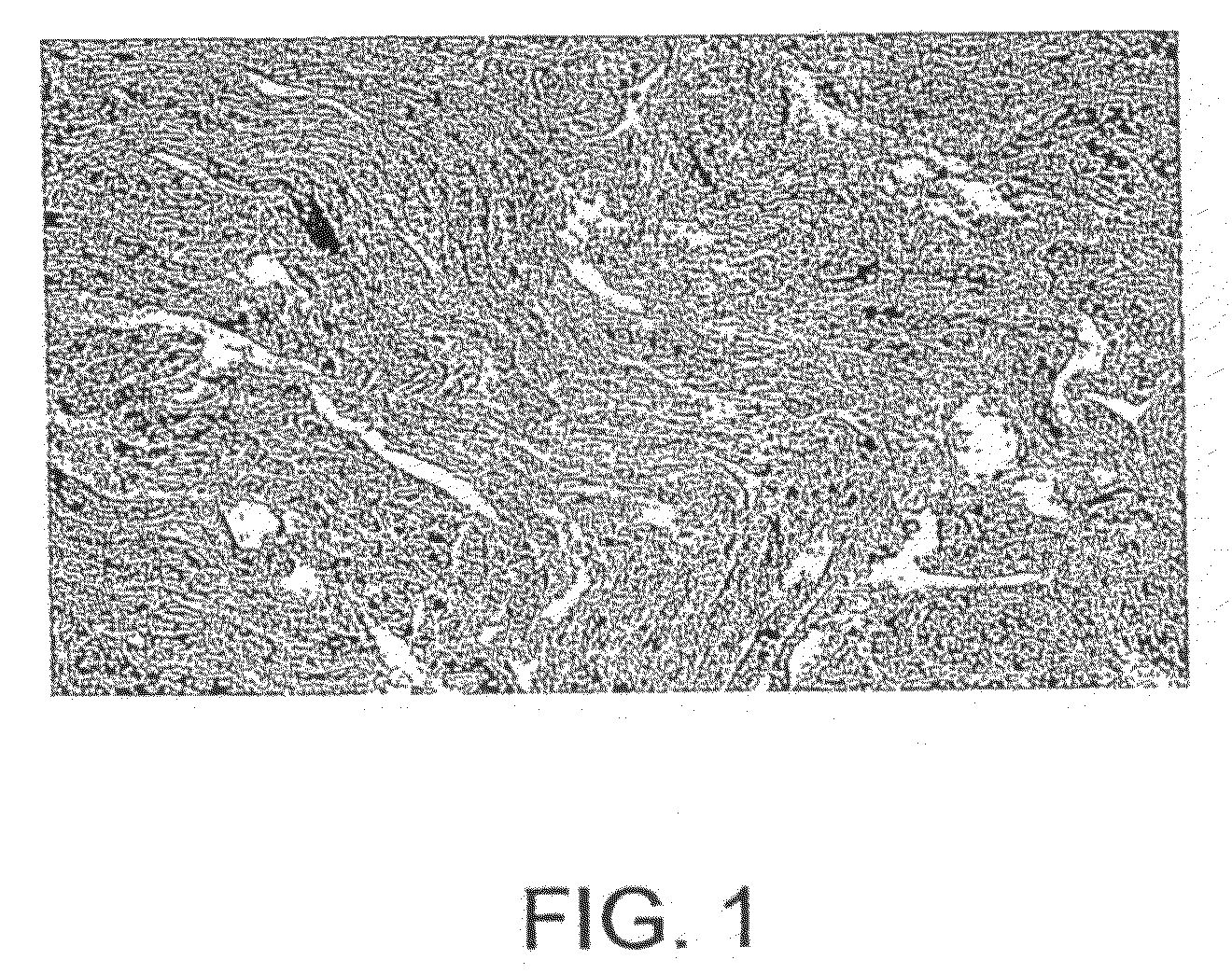 20-Cyclopropyl, 26,27-Alkyl/Haloalkyl Vitamin D3 Compounds and Methods of Use Thereof