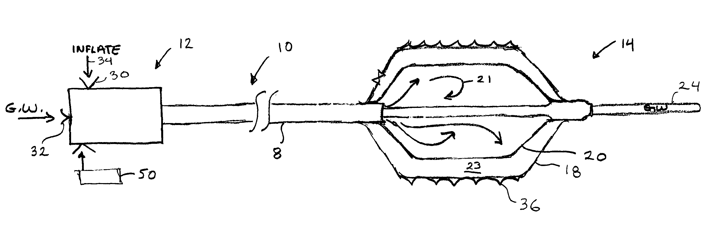 Vascular treatment method and device