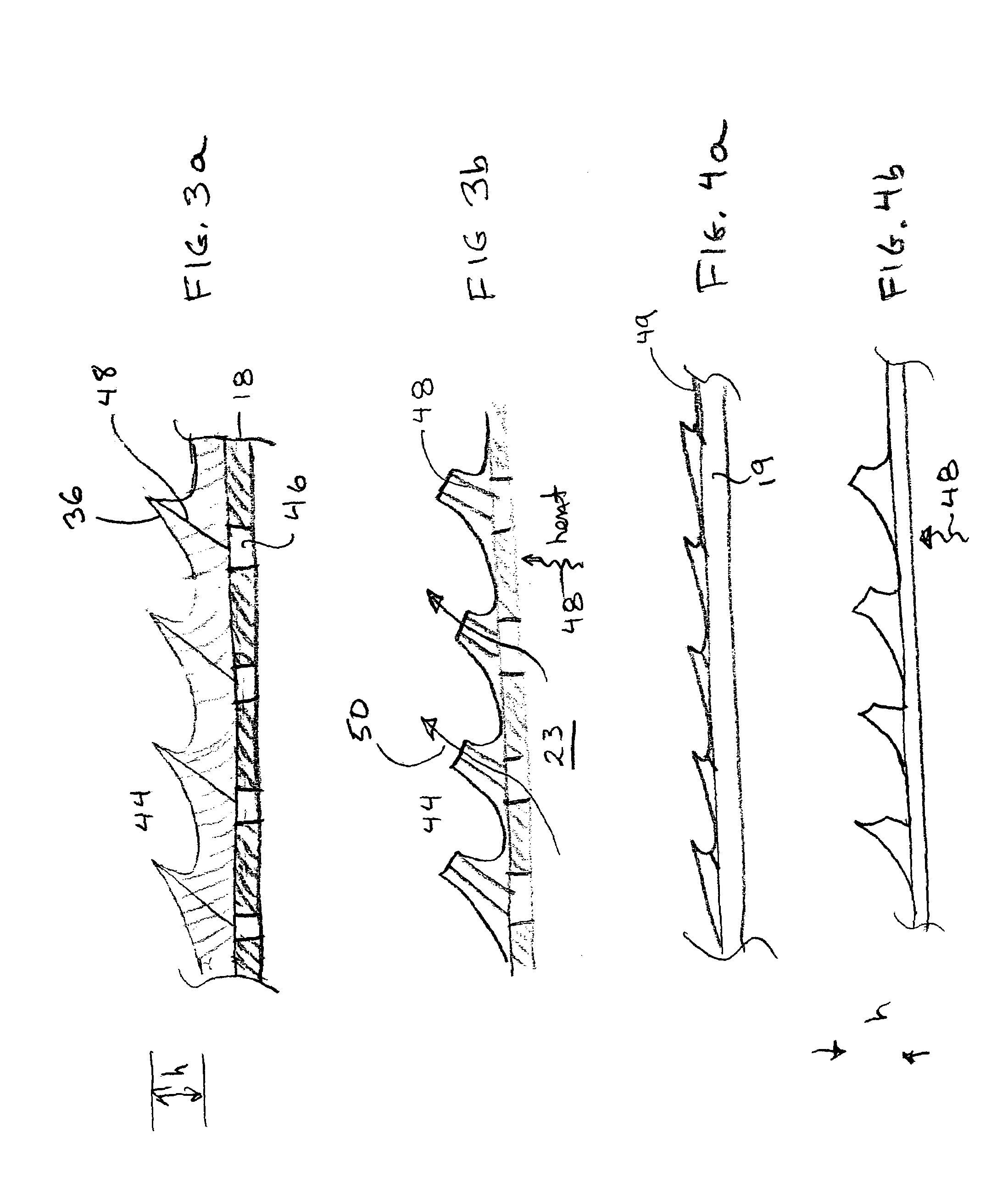 Vascular treatment method and device