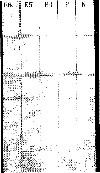 Method for quickly processing filter-type micro nucleic acid clinical samples