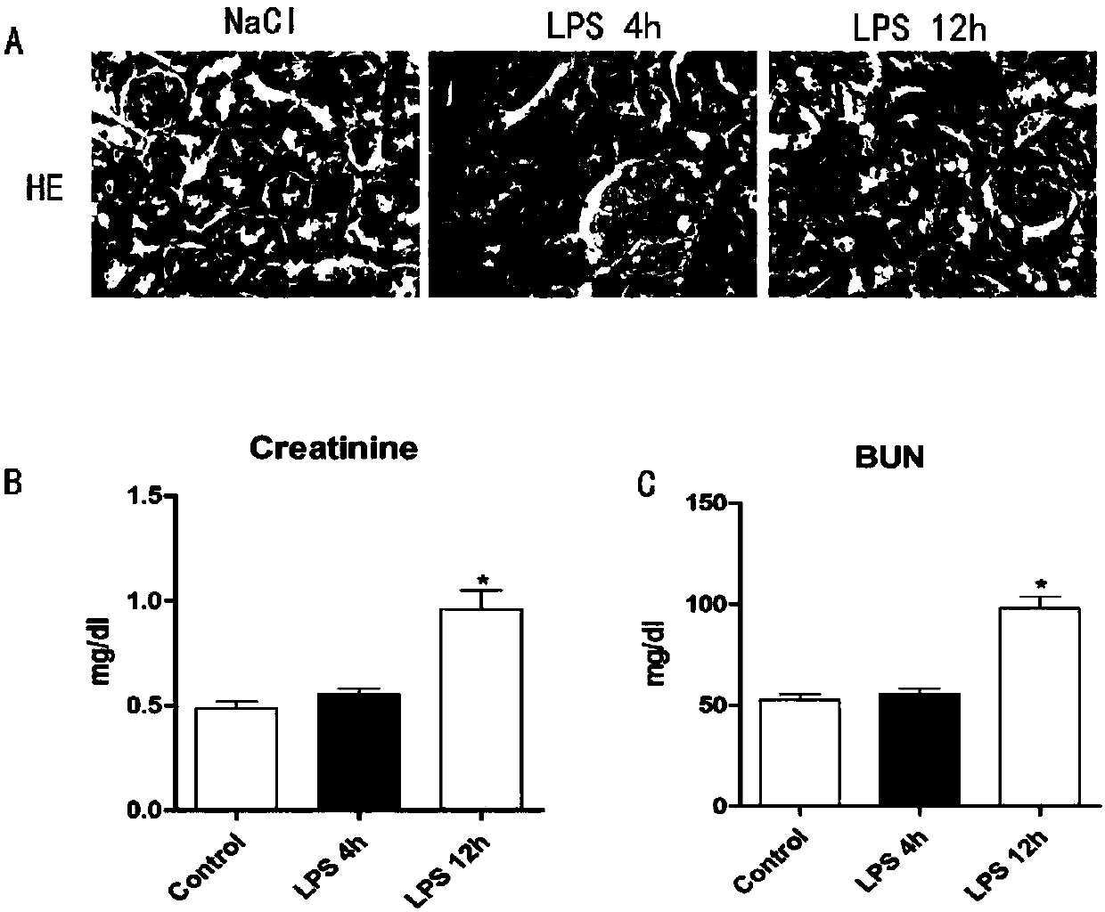 Molecular marker miR-452 for early diagnosing acute kidney injury caused by septicopyemia, kit and application thereof