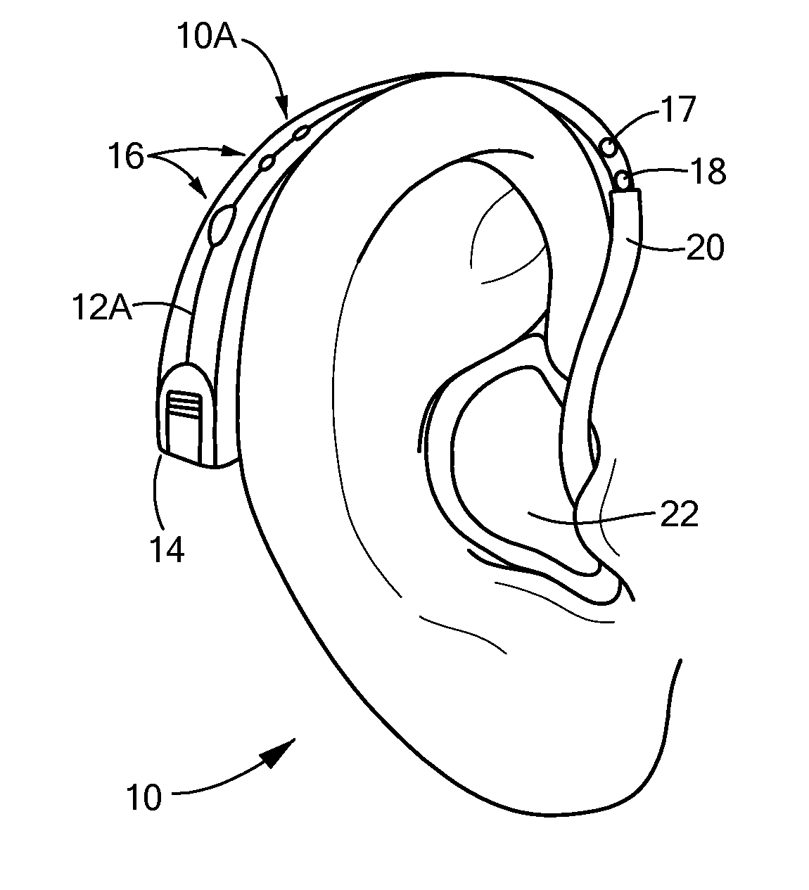 Noise Mitigating Microphone System