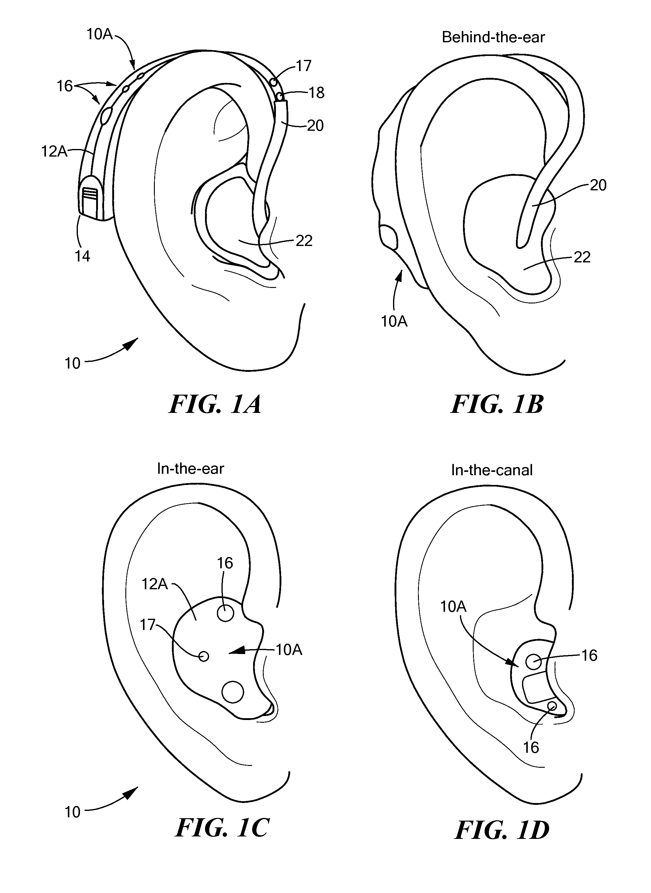 Noise Mitigating Microphone System