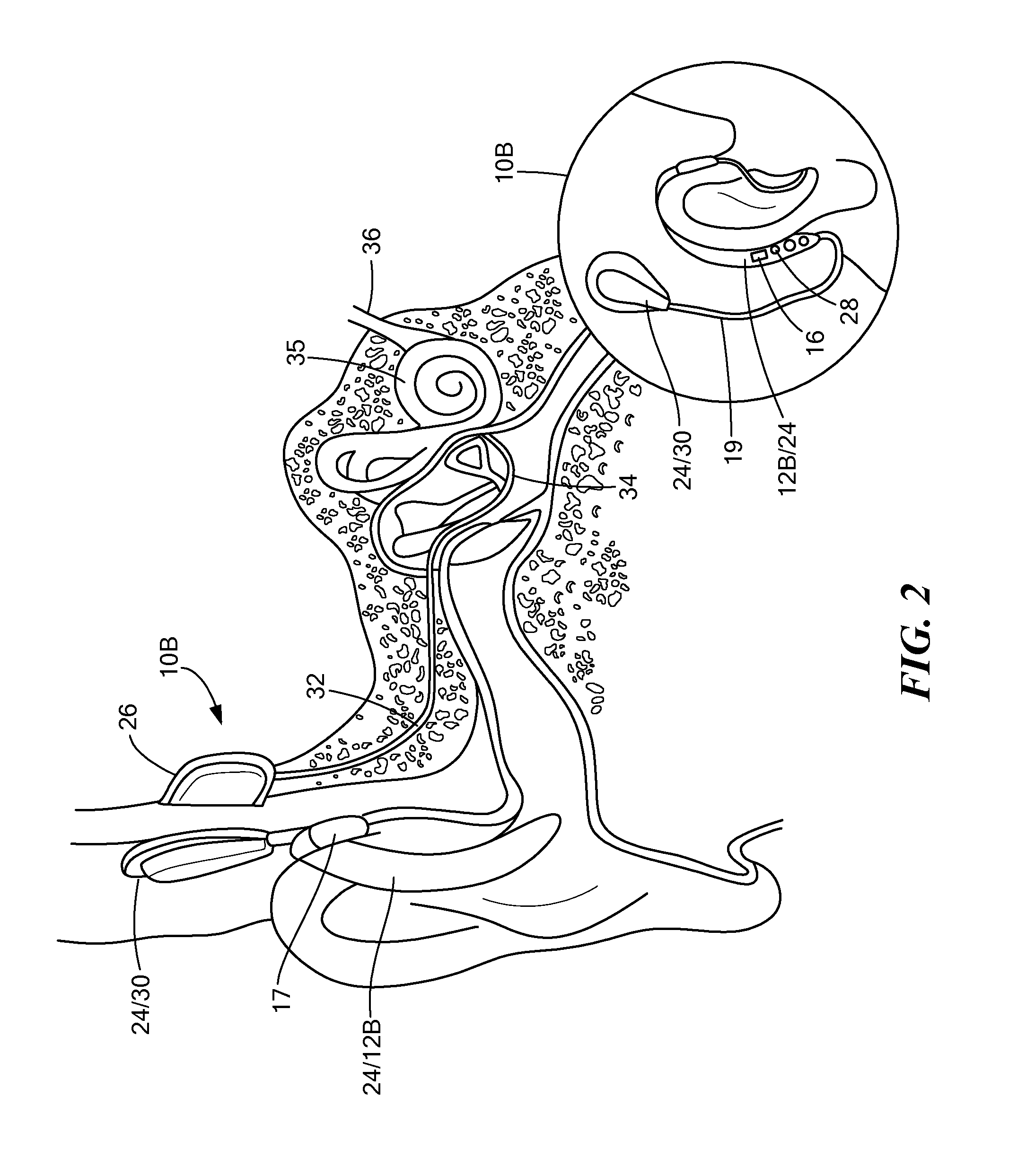 Noise Mitigating Microphone System