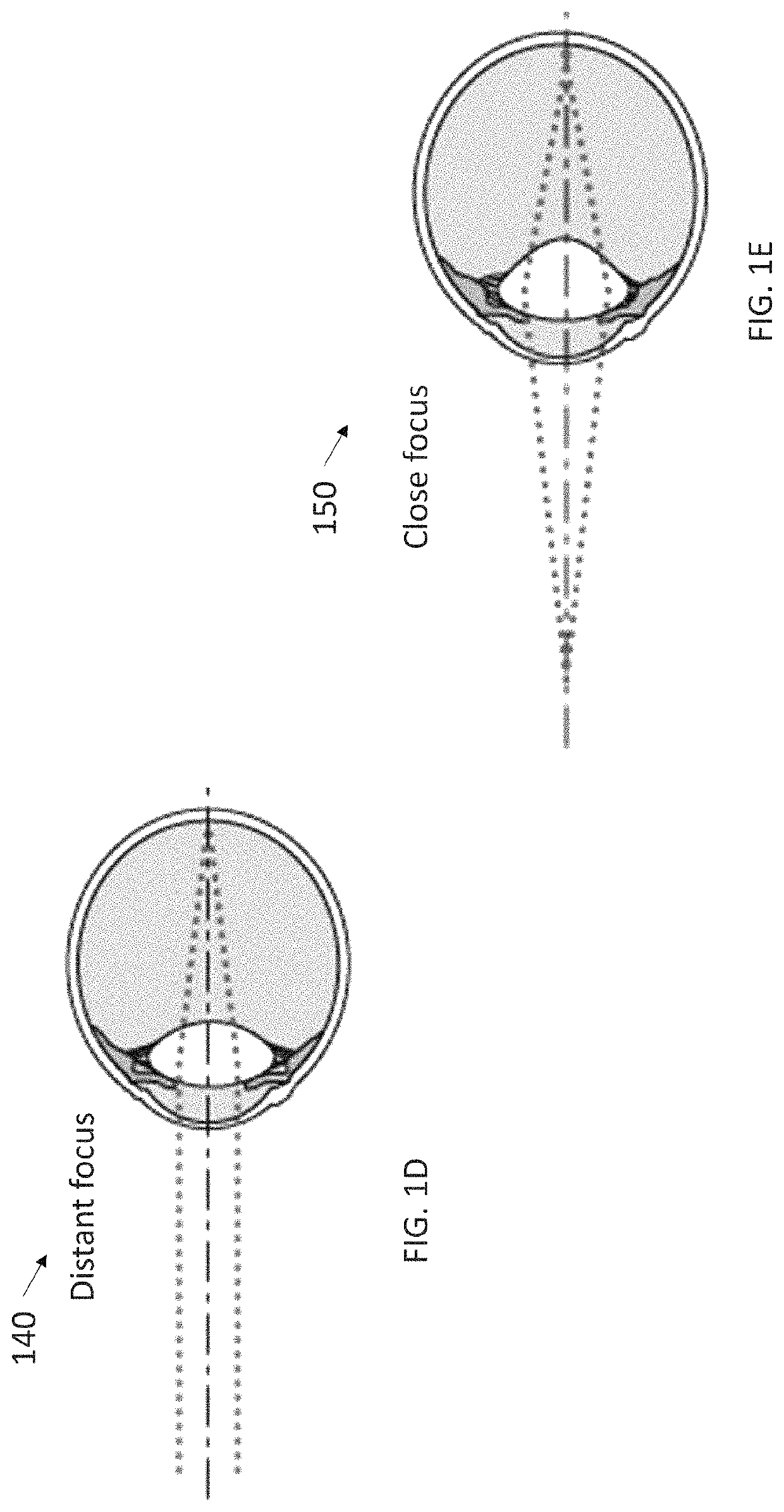 System and methods using real-time predictive virtual 3D eye finite element modeling for simulation of ocular structure biomechanics