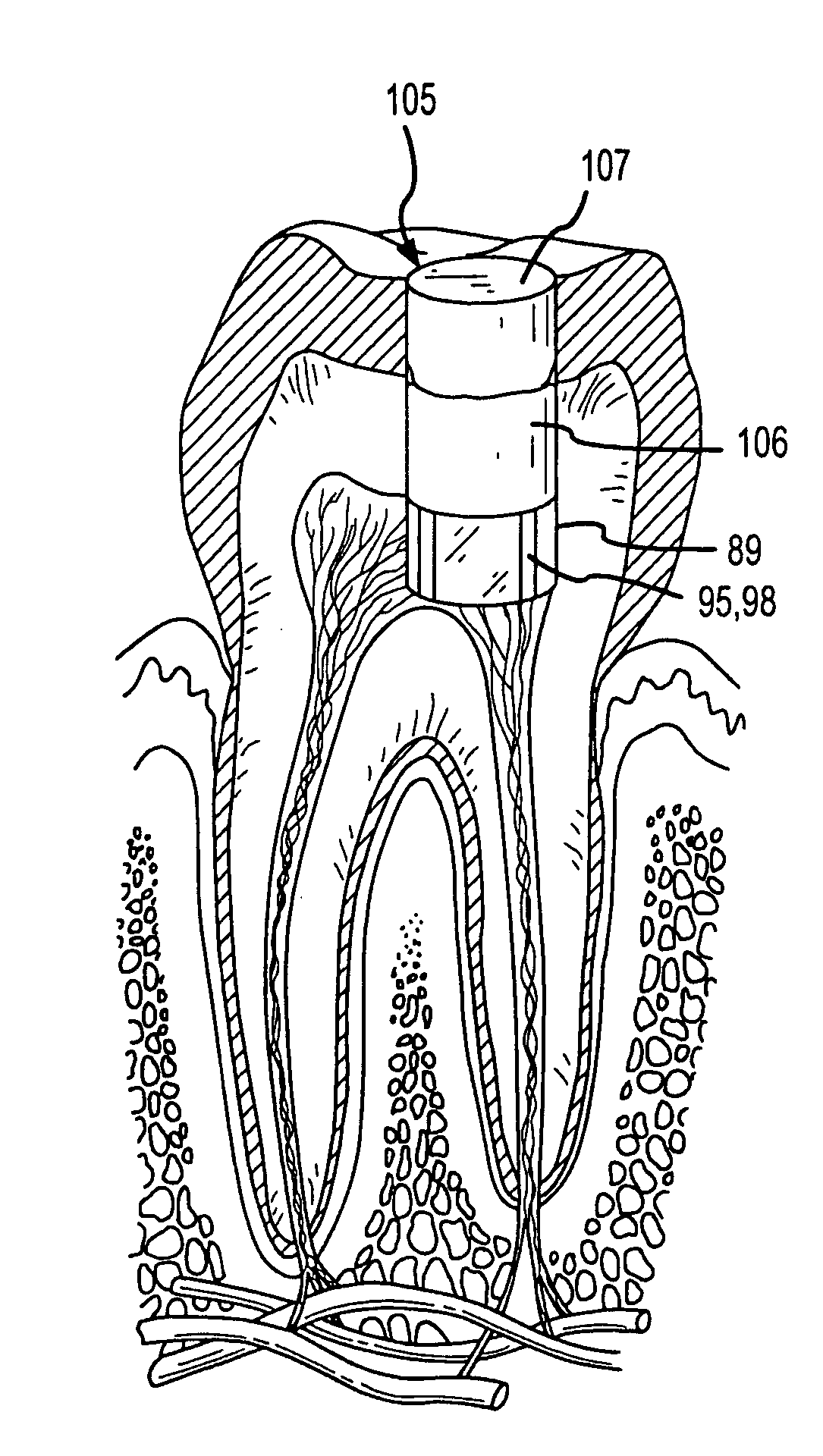 Methods for treating dental conditions using tissue scaffolds