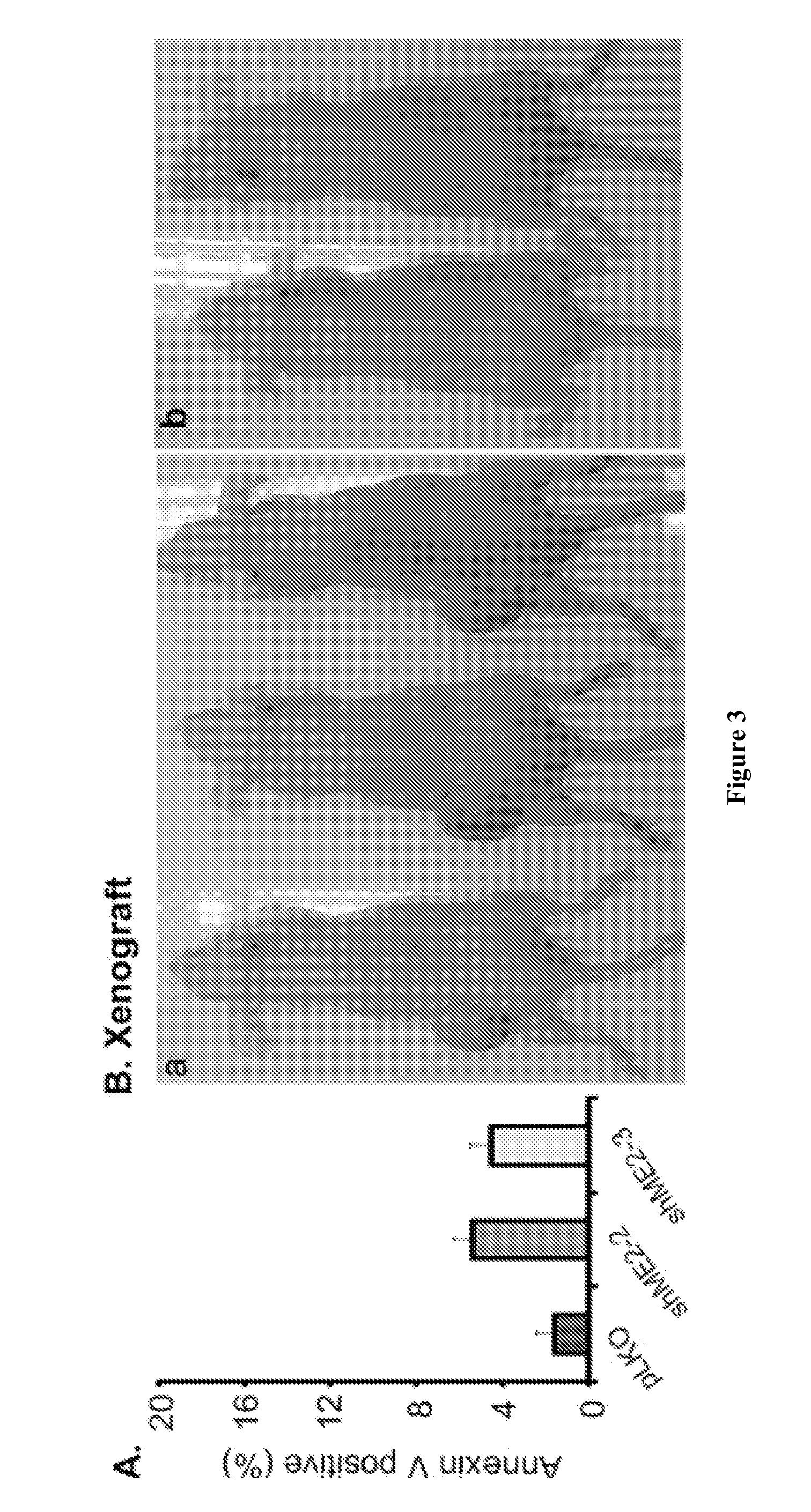 Methods and compositions for malic enzyme 2 (ME2) as a target for cancer therapy