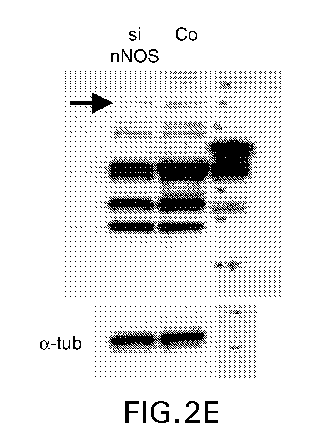 Delivery Of Double-Stranded RNA Into The Central Nervous System