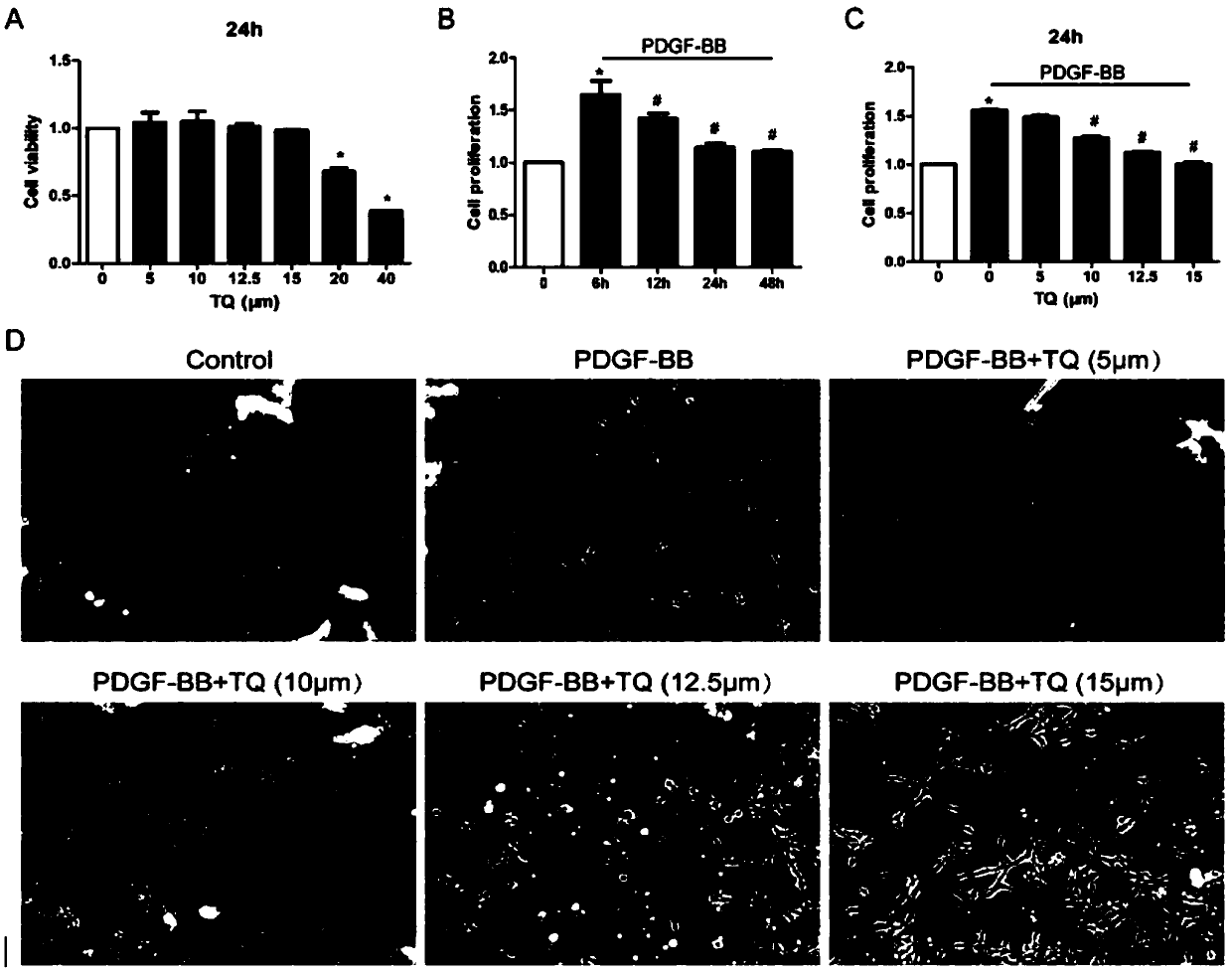 Application of thymoquinone (TQ) to preparation of drugs for preventing vascular stent restenosis