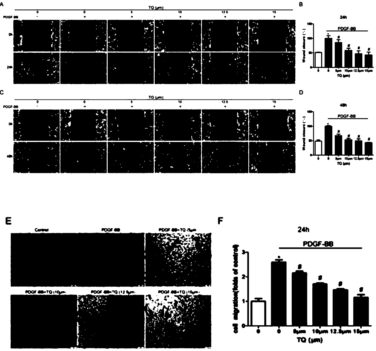 Application of thymoquinone (TQ) to preparation of drugs for preventing vascular stent restenosis