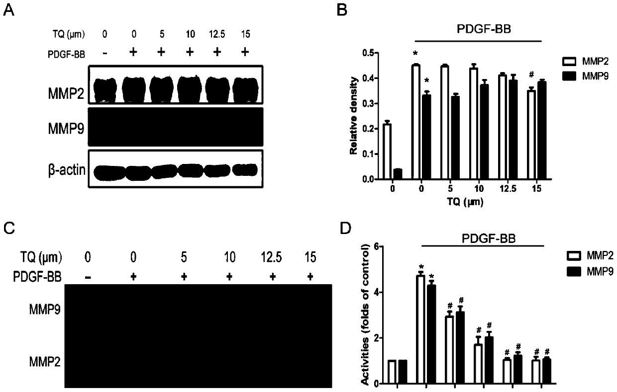 Application of thymoquinone (TQ) to preparation of drugs for preventing vascular stent restenosis