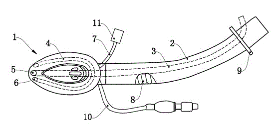 Anti-reflux laryngeal mask