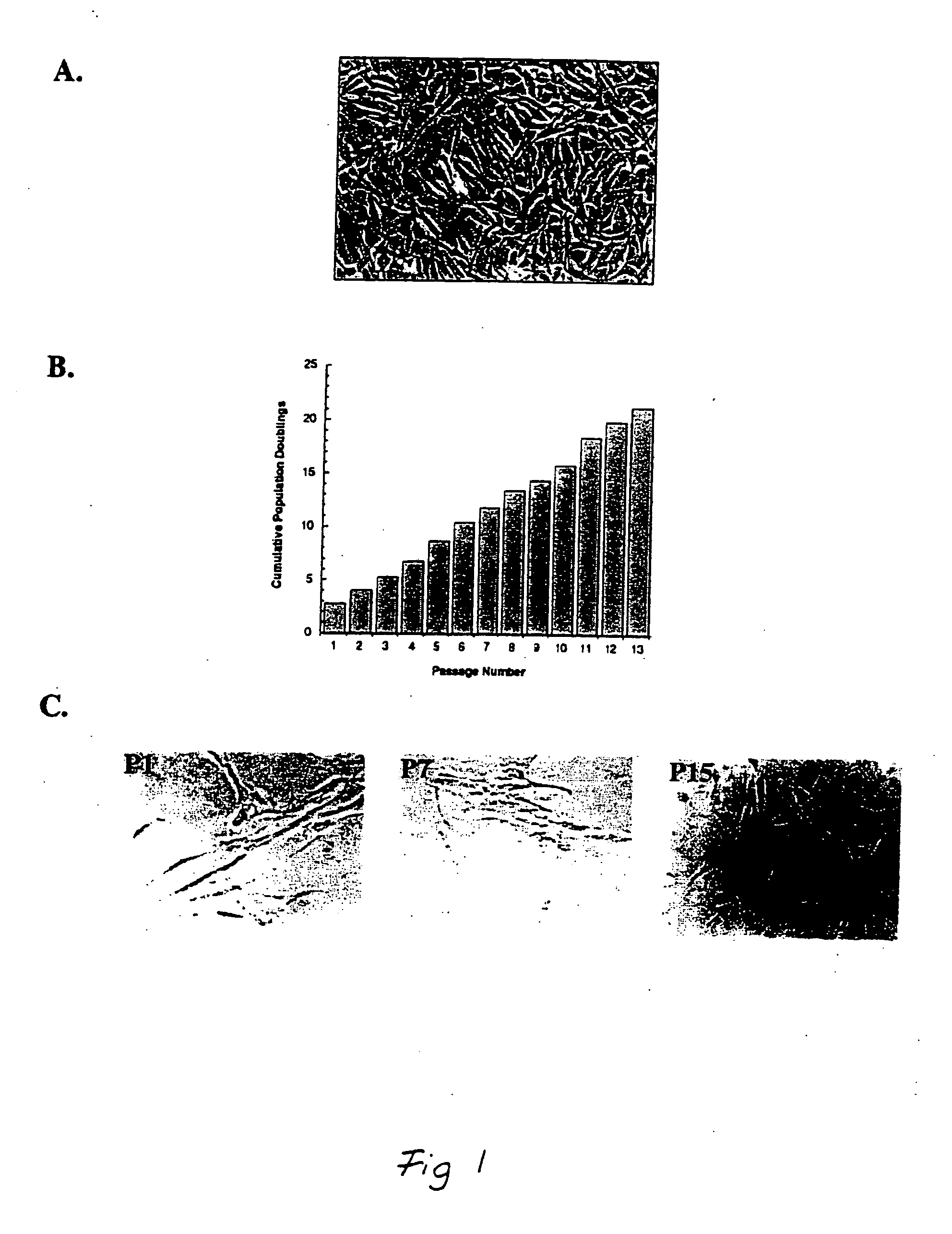 Adipose-derived stem cells and lattices