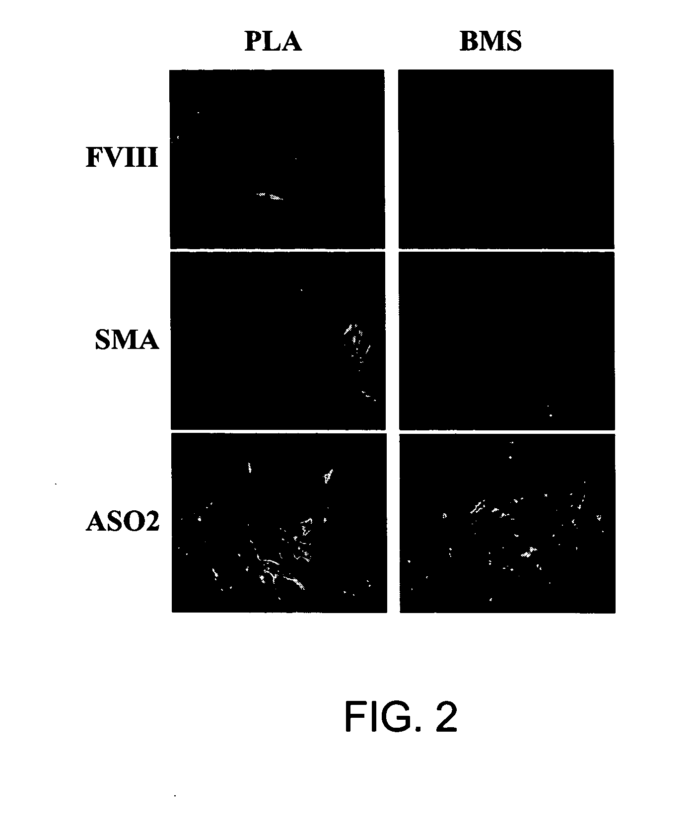 Adipose-derived stem cells and lattices