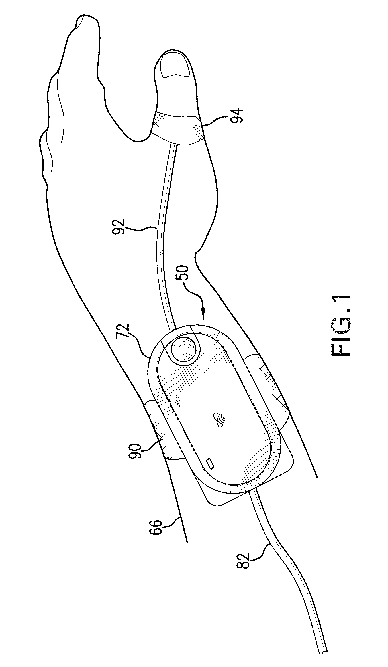 Body-worn vital sign monitor