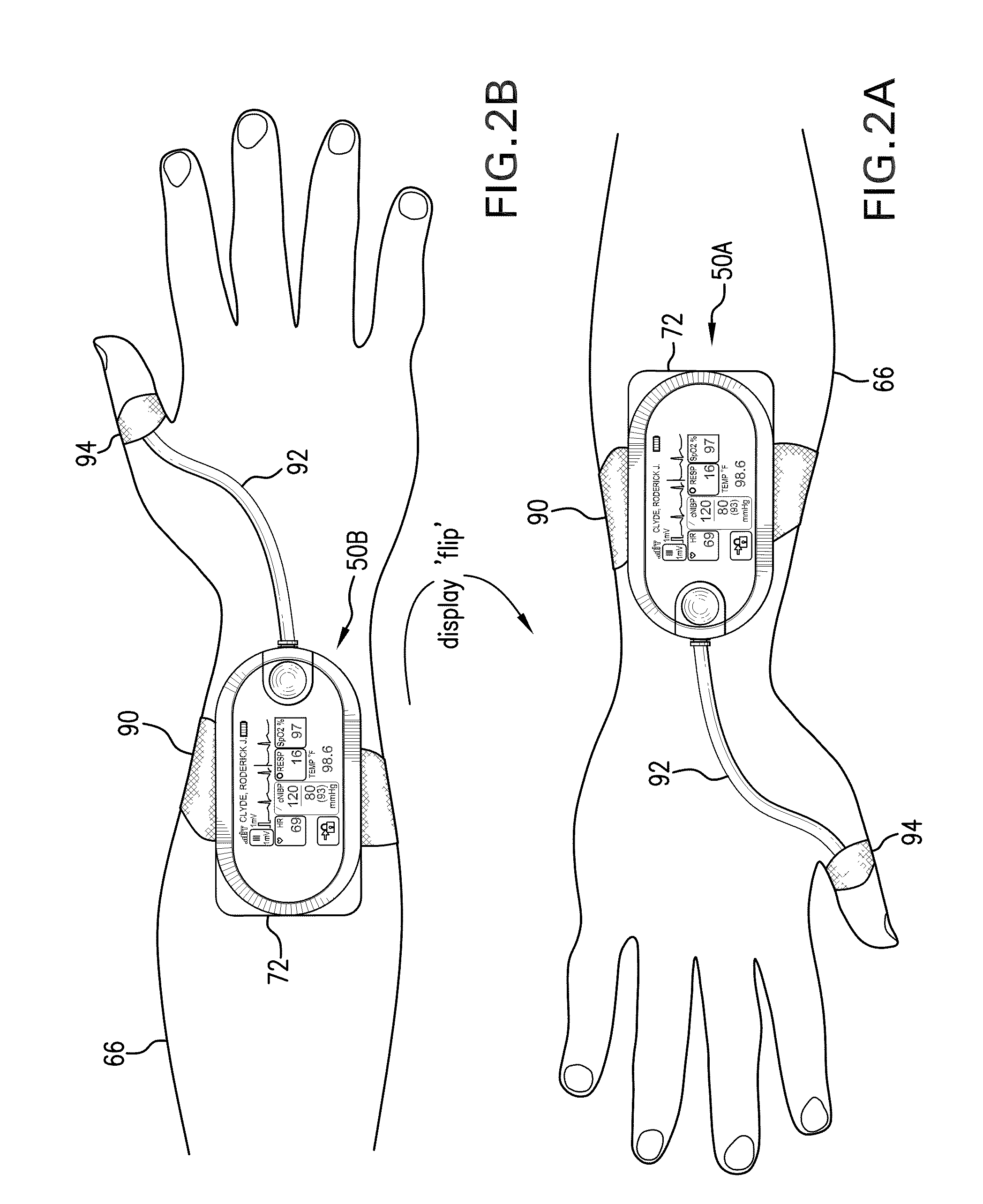 Body-worn vital sign monitor