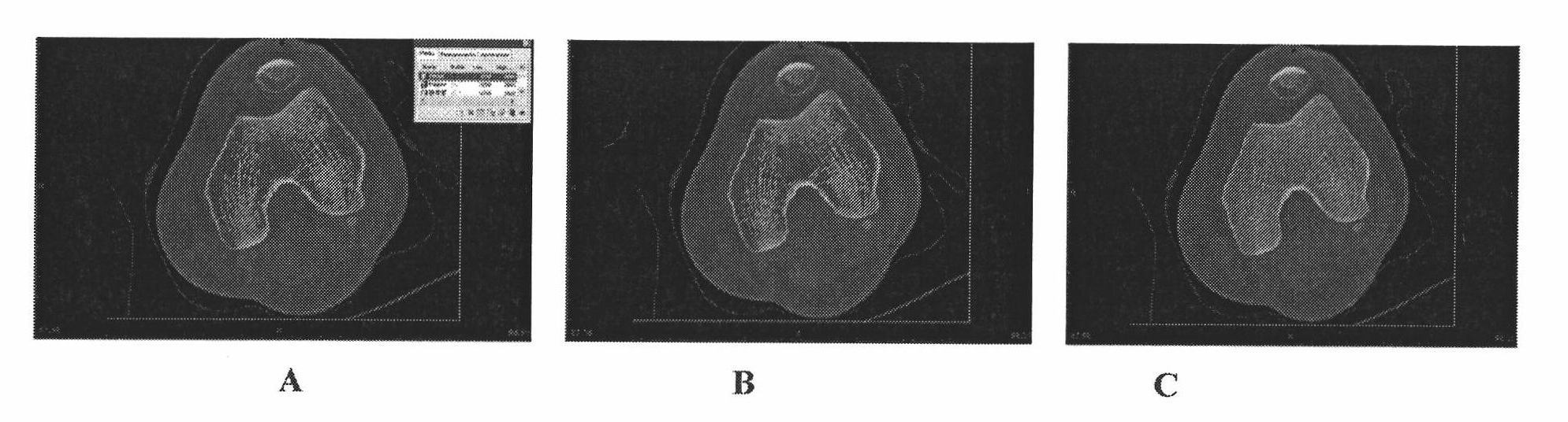 Method for positioning human body knee joint flexible motion axis in lateral femoral condyle long-axis section