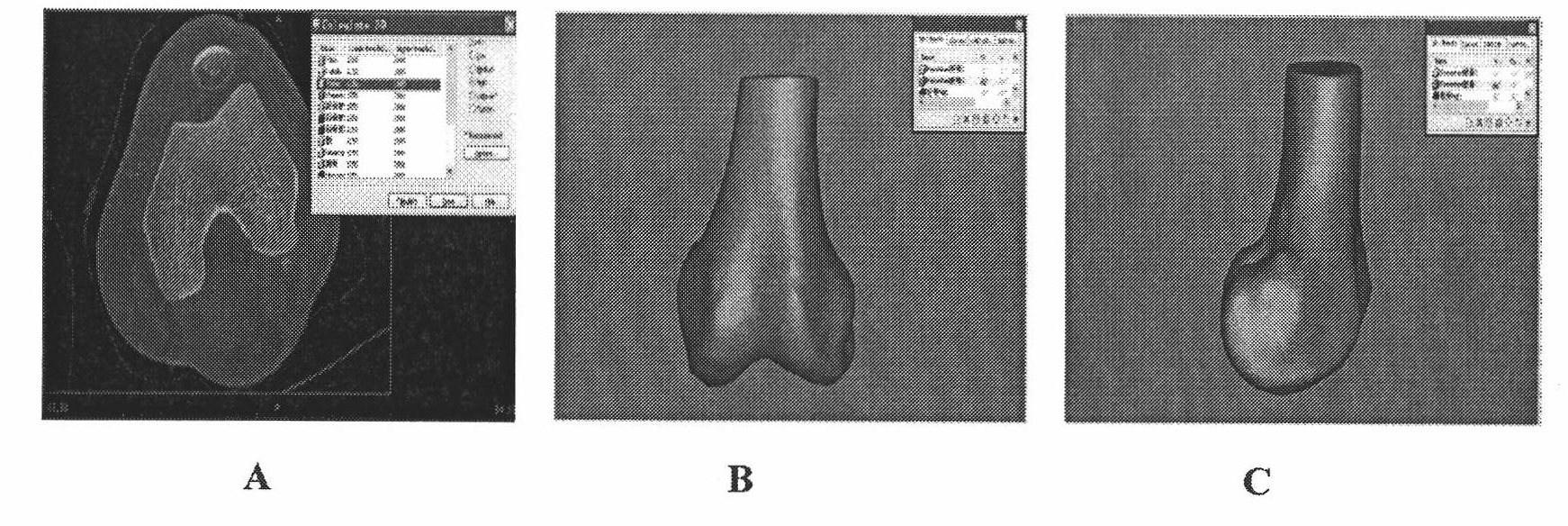 Method for positioning human body knee joint flexible motion axis in lateral femoral condyle long-axis section