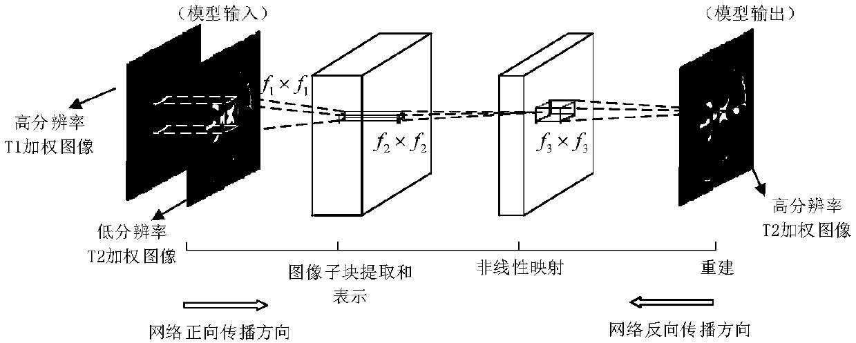 Convolutional-neural-network-based multi-contrast magnetic resonance image reconstruction method