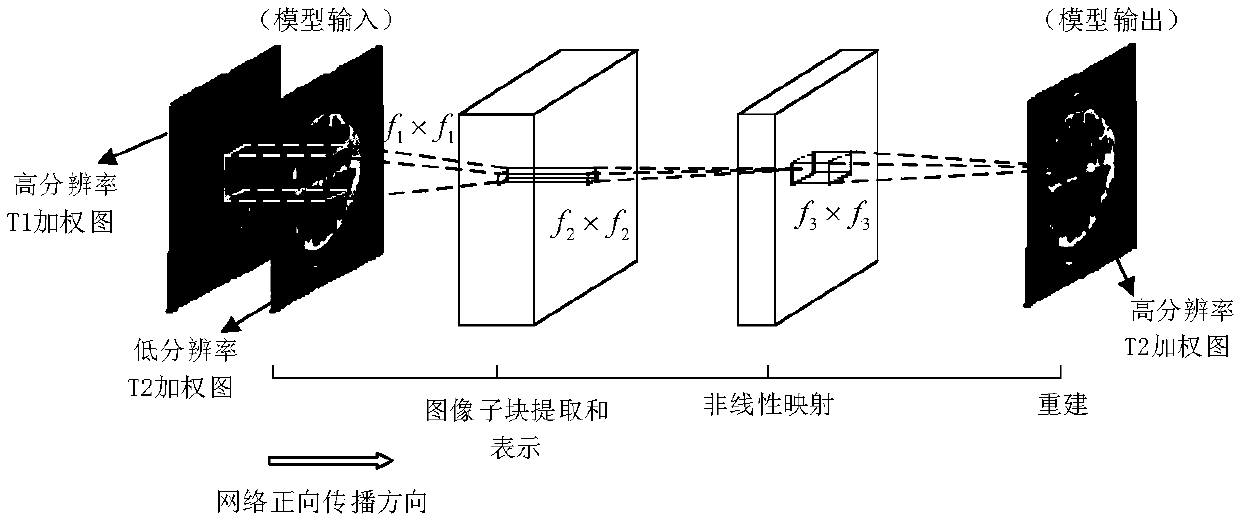 Convolutional-neural-network-based multi-contrast magnetic resonance image reconstruction method