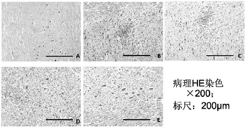 Pharmaceutical composition for treating central nervous system inflammatory demyelinating diseases and application of pharmaceutical composition in combined administration