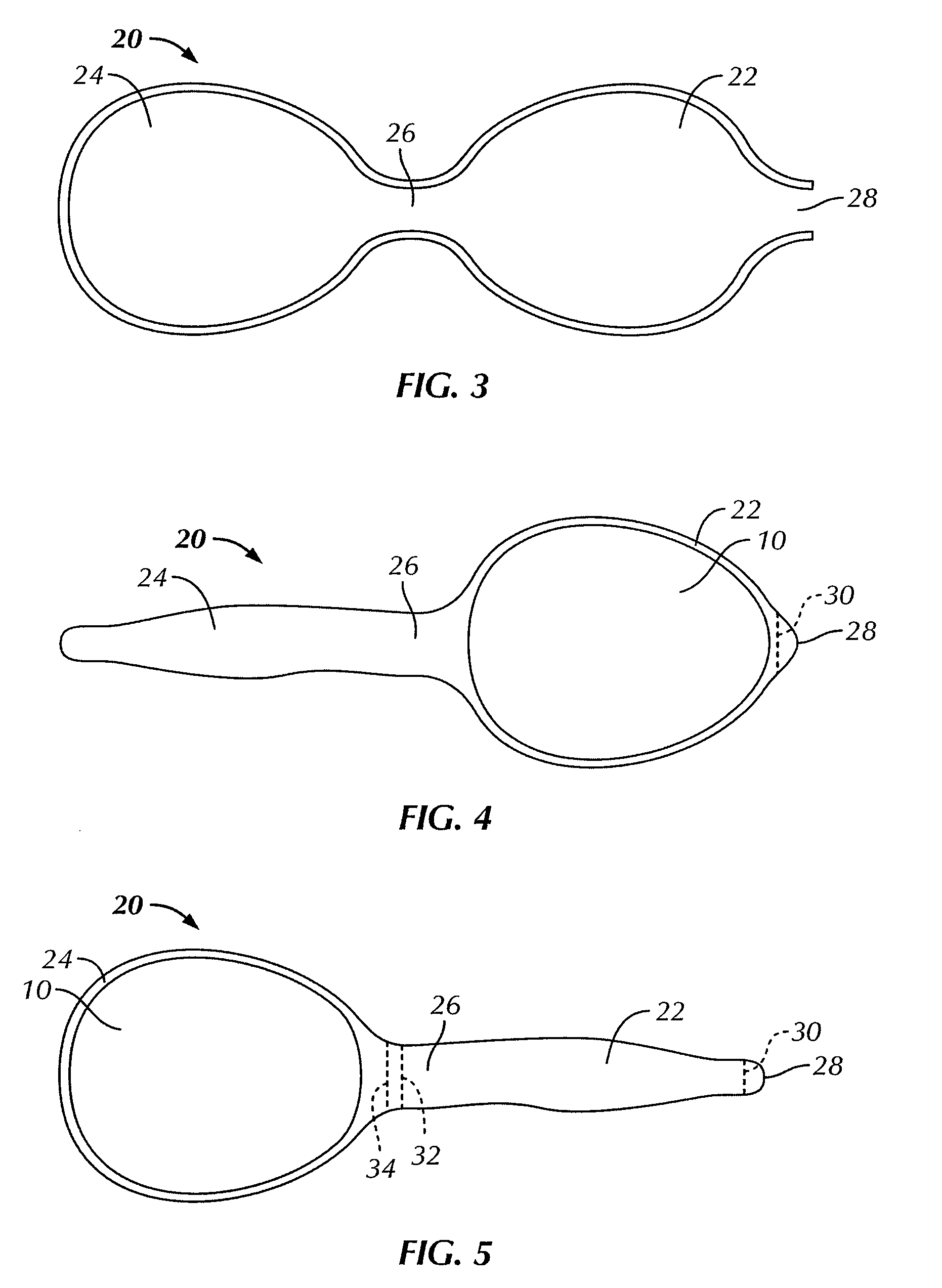 Breast implant implantation method and apparatus