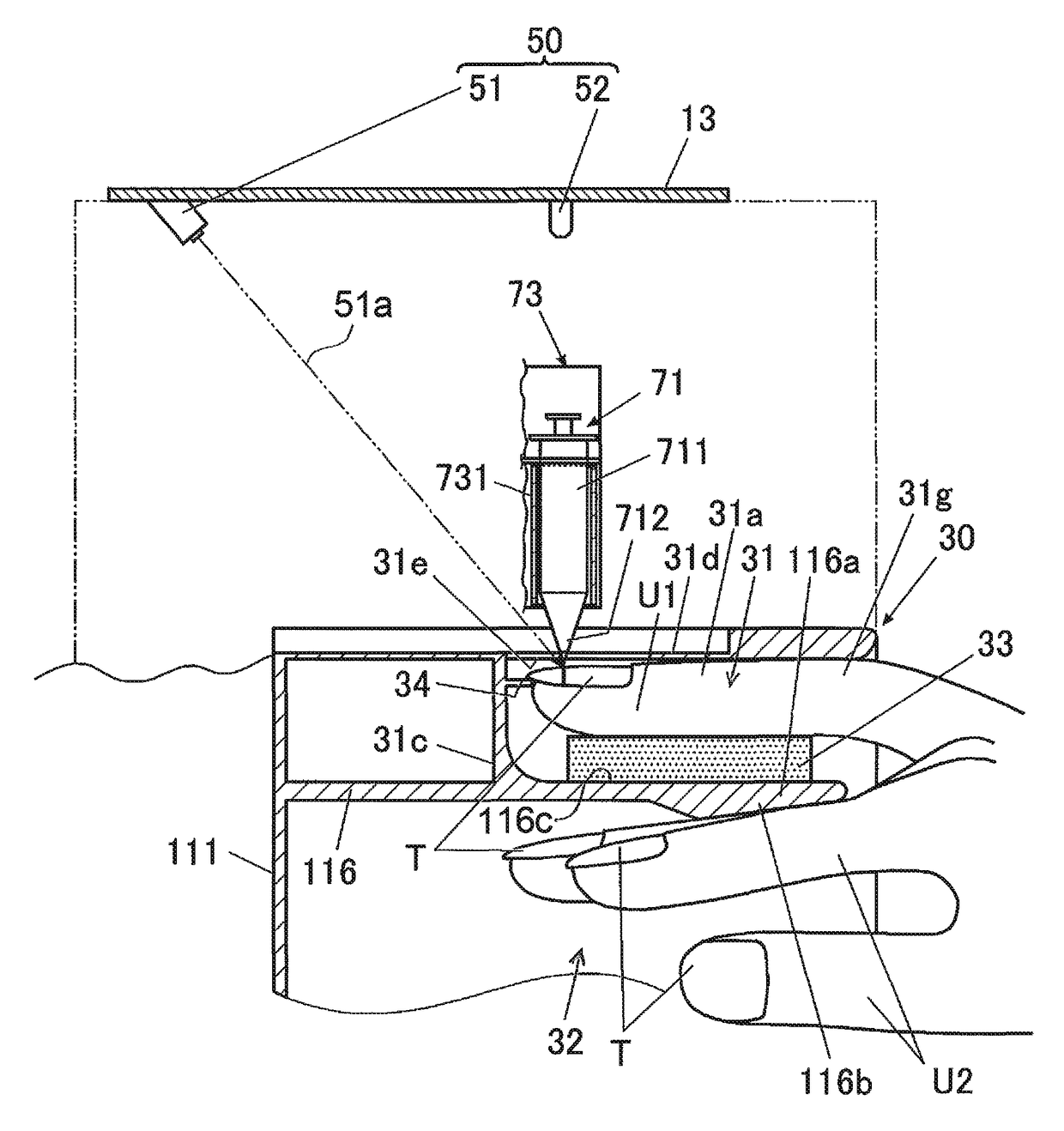 Drawing device and method for detecting shape of nail in the same