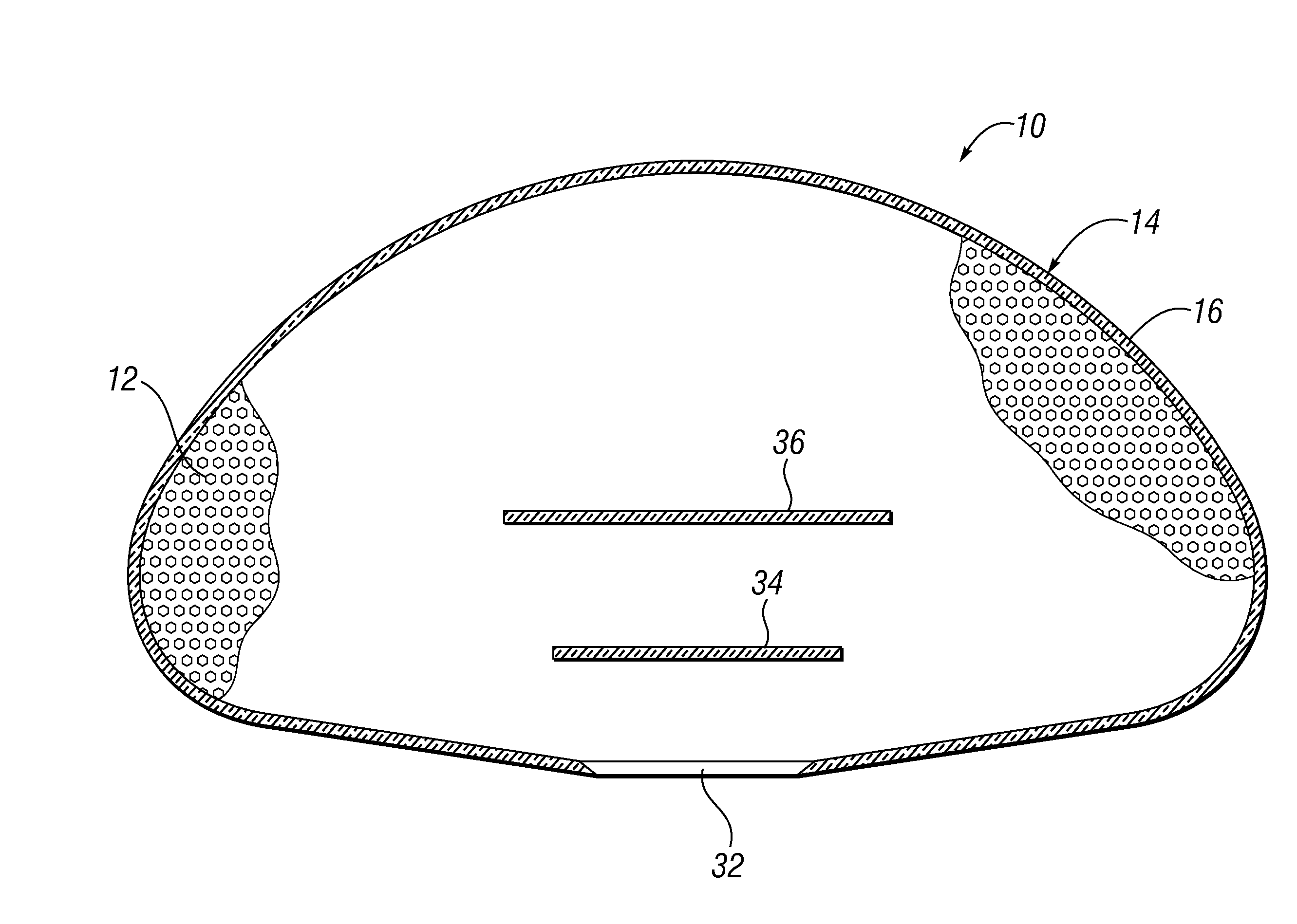 All-barrier elastomeric gel-filled breast prosthesis