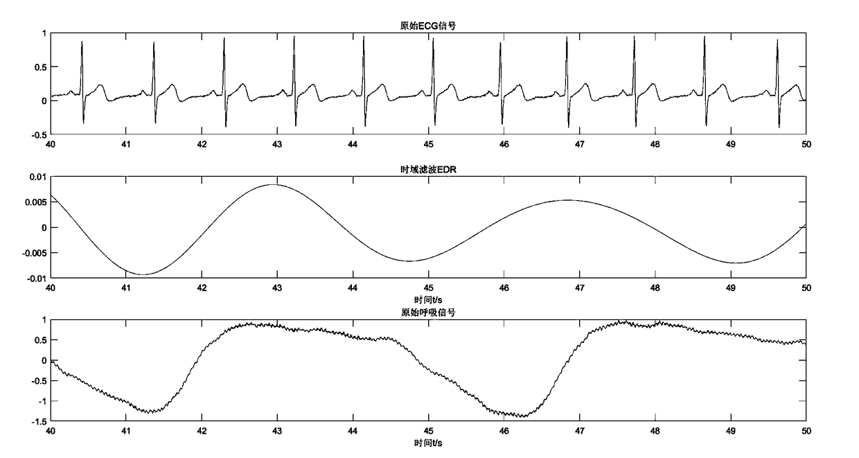 Diagnosis and treatment system for obstructive sleep apnea syndromes