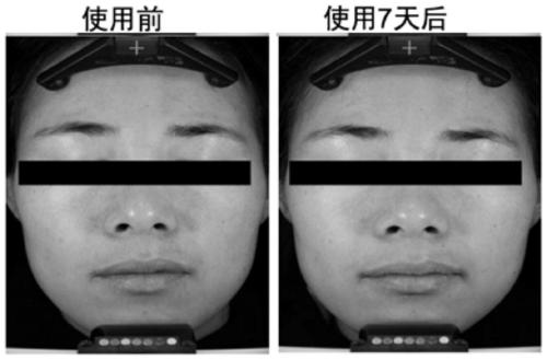 Application of a combination fermentation product of thermophilic thermus and saccharomyces