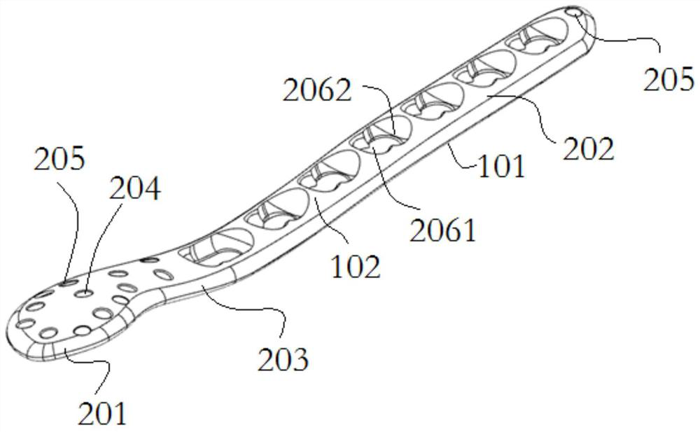 Orthopedic implant