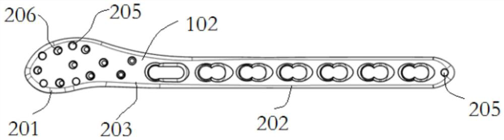 Orthopedic implant