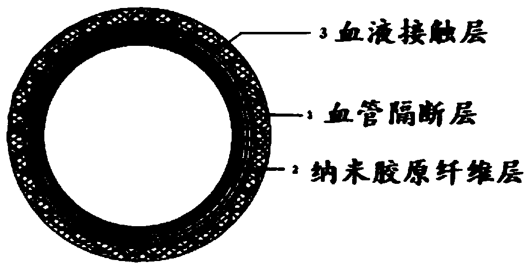 Preparation method of artificial blood vessel