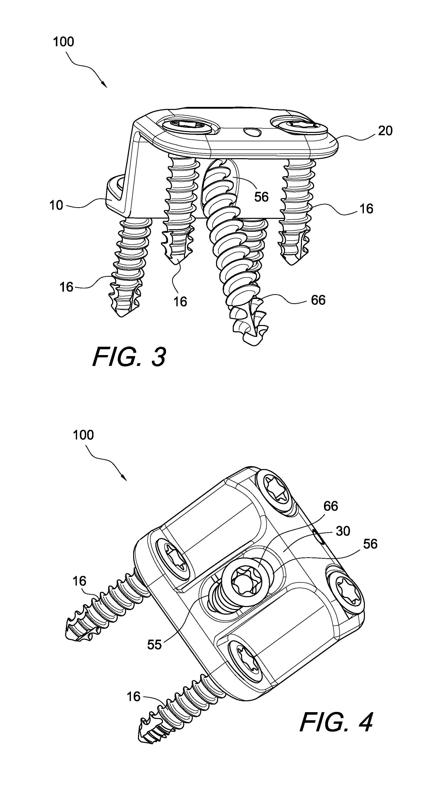 Calcaneus step plate