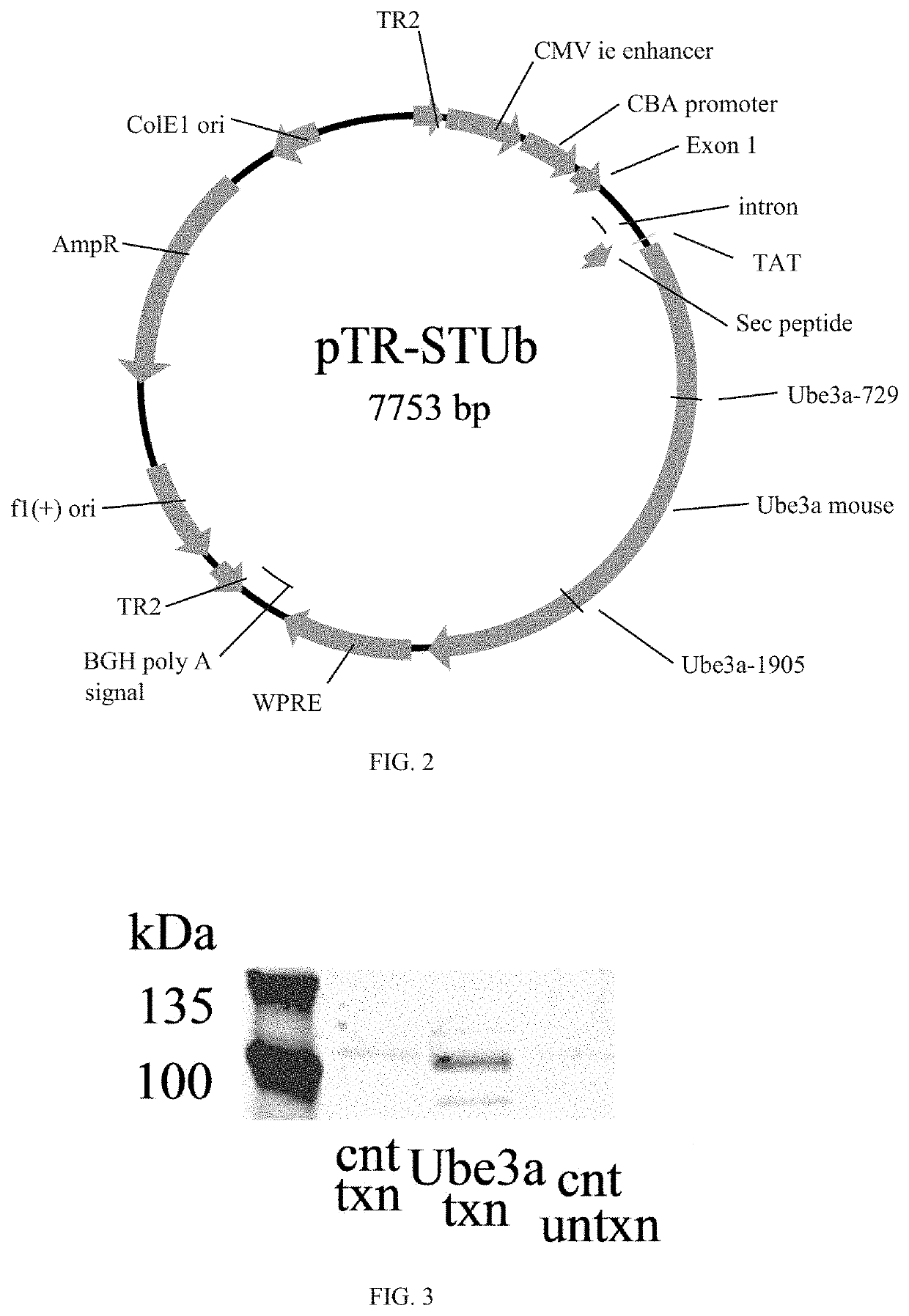 Modified ube3a gene for a gene therapy approach for angelman syndrome