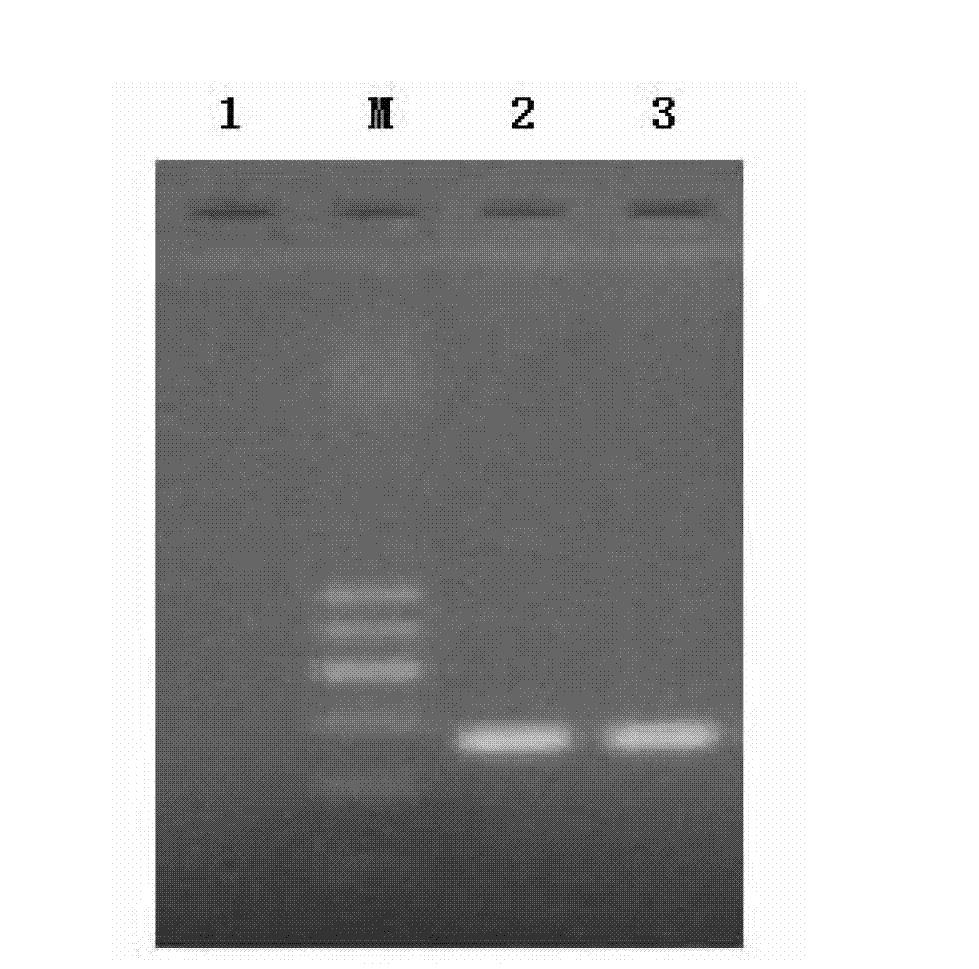 Detection reagent kit and detection method of aeromonas bacteria