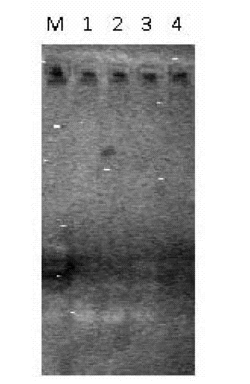 Detection reagent kit and detection method of aeromonas bacteria