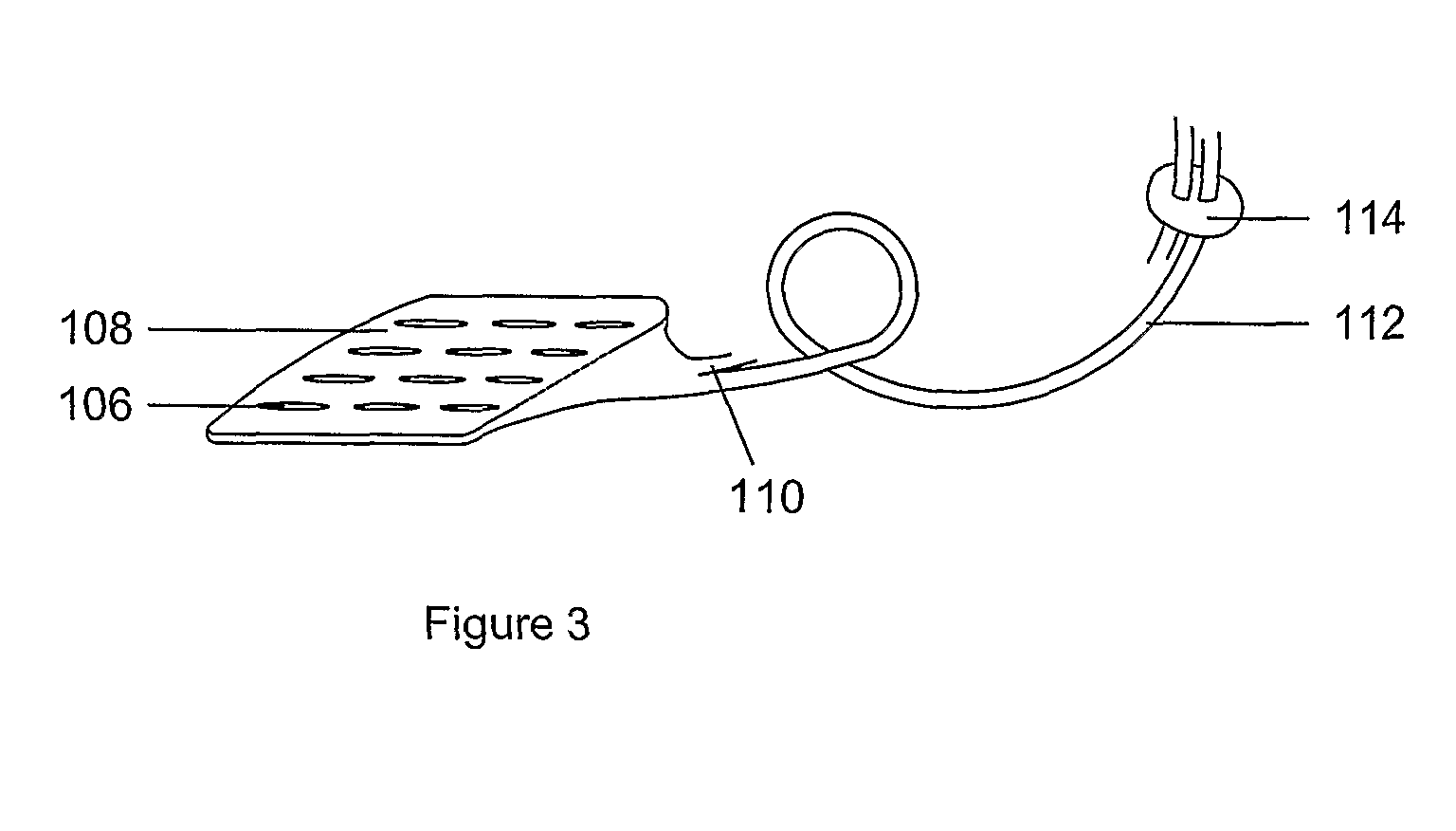 Electrostimulation Device