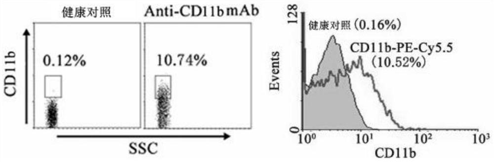 Application of CD11b positive exosome in tumor prognosis evaluation