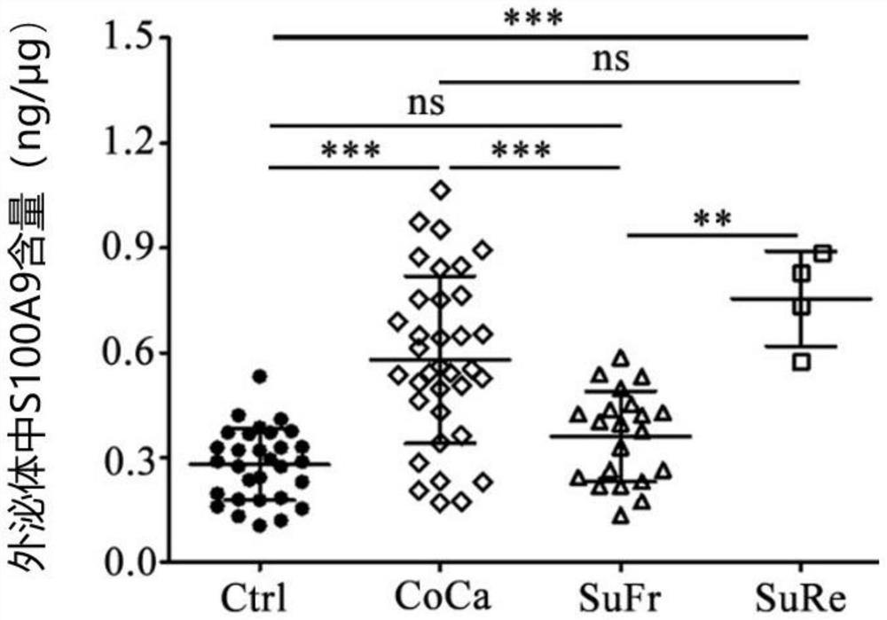 Application of CD11b positive exosome in tumor prognosis evaluation