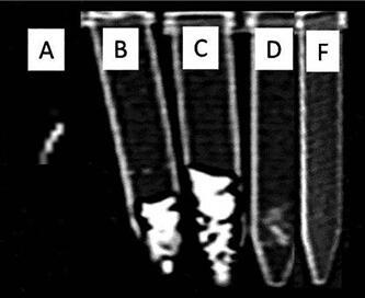 A kind of preparation method of tree cotton anti-radiation fiber