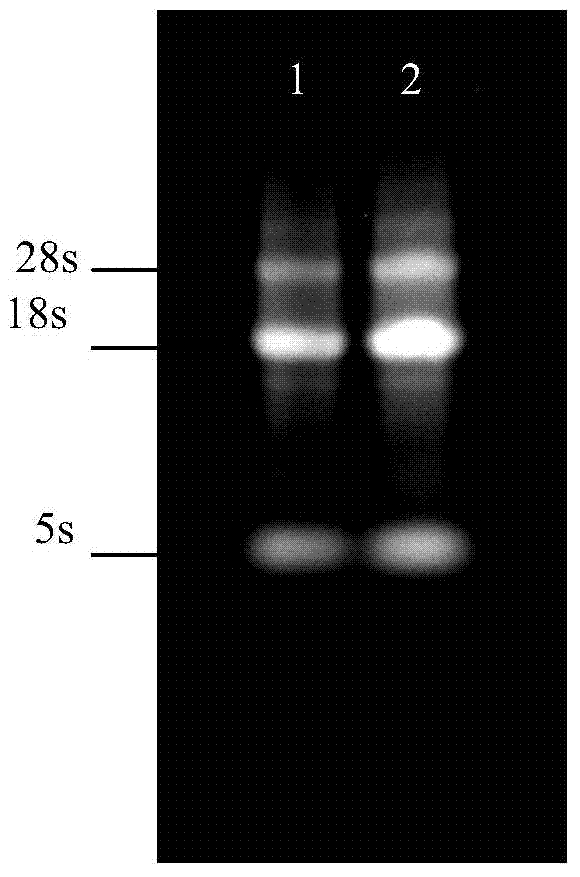 Carboxylesterase gene dsRNA and applications thereof in prevention and treatment of sitobion avenae