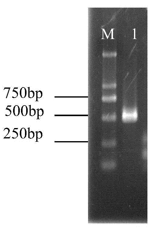 Carboxylesterase gene dsRNA and applications thereof in prevention and treatment of sitobion avenae