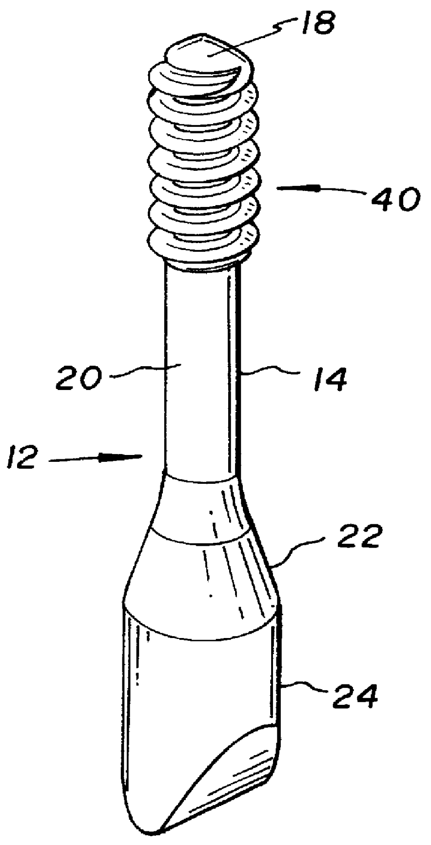 Allograft bone fixation screw method and apparatus