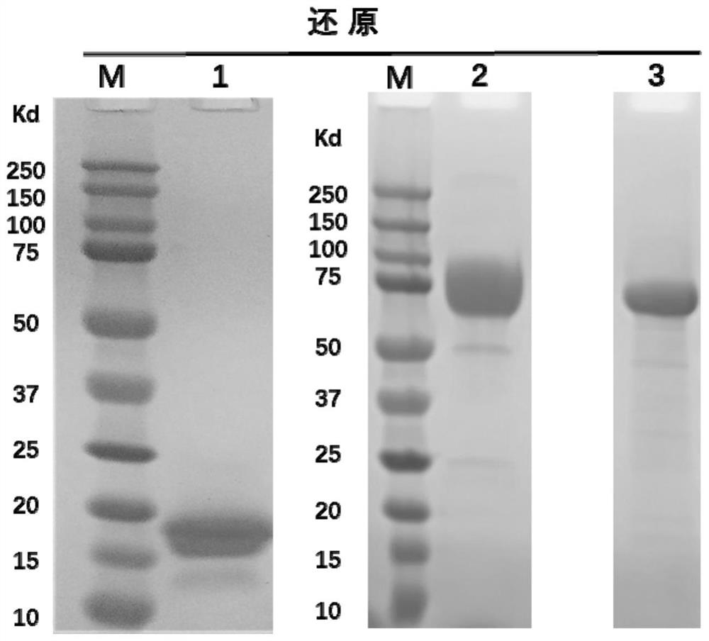 Human anti-human tigit antibody and its application