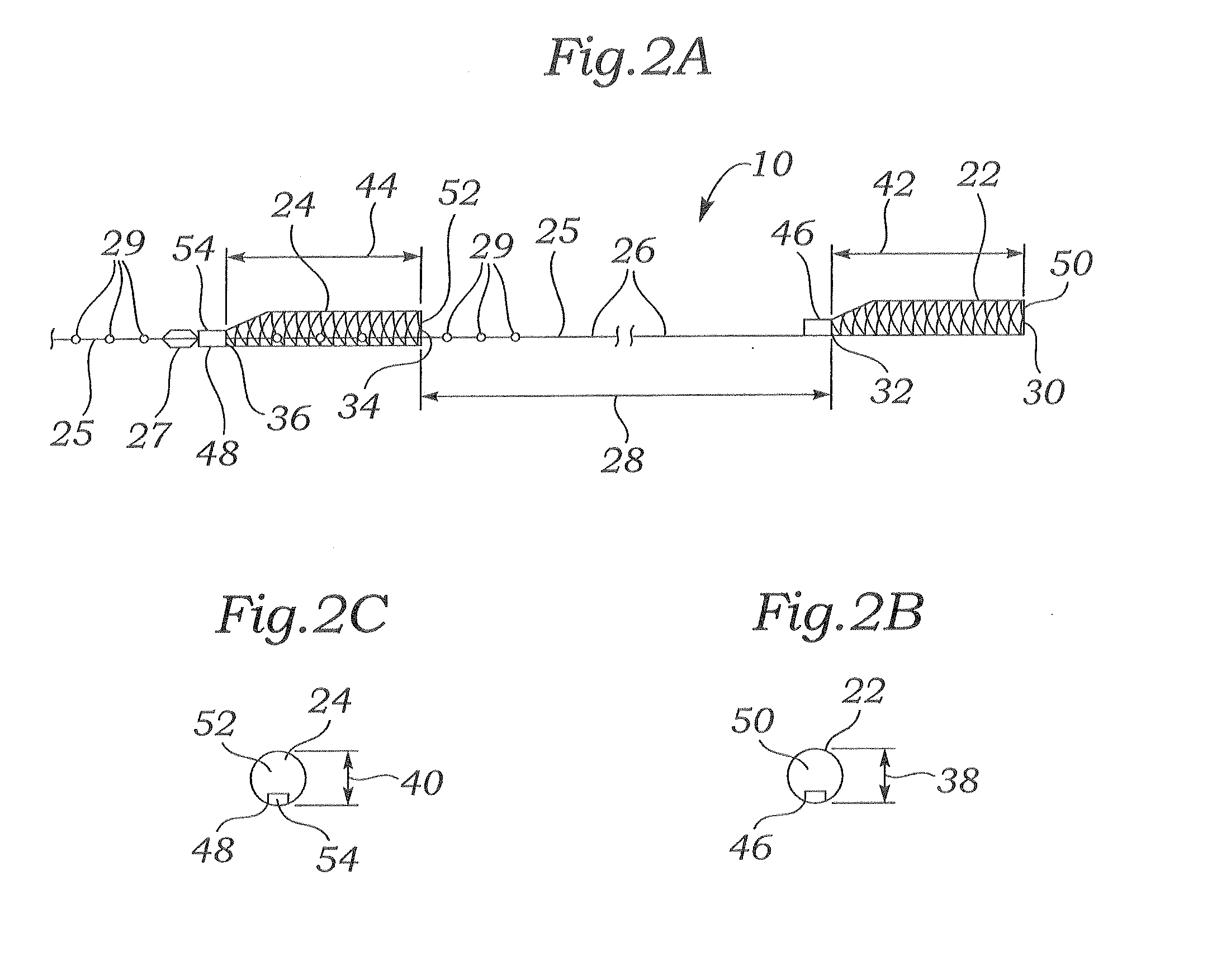 Retrievable implant and method for treatment of mitral regurgitation