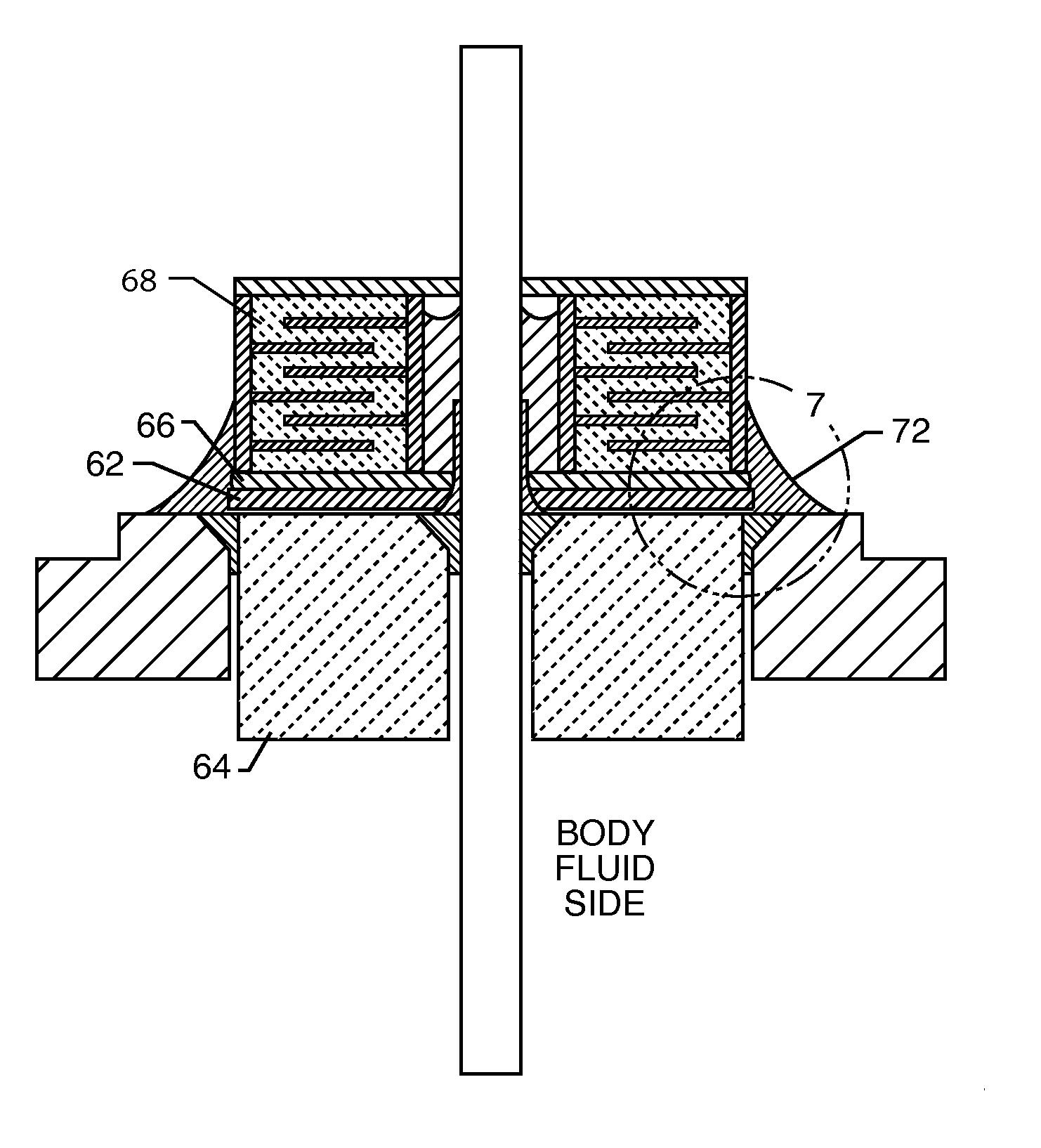 Feedthrough filter terminal assemblies with breathable components to facilitate leak testing